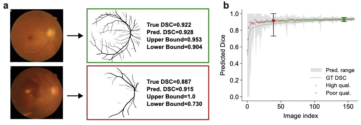 Conformal Performance Range Prediction for Segmentation Output Quality Control